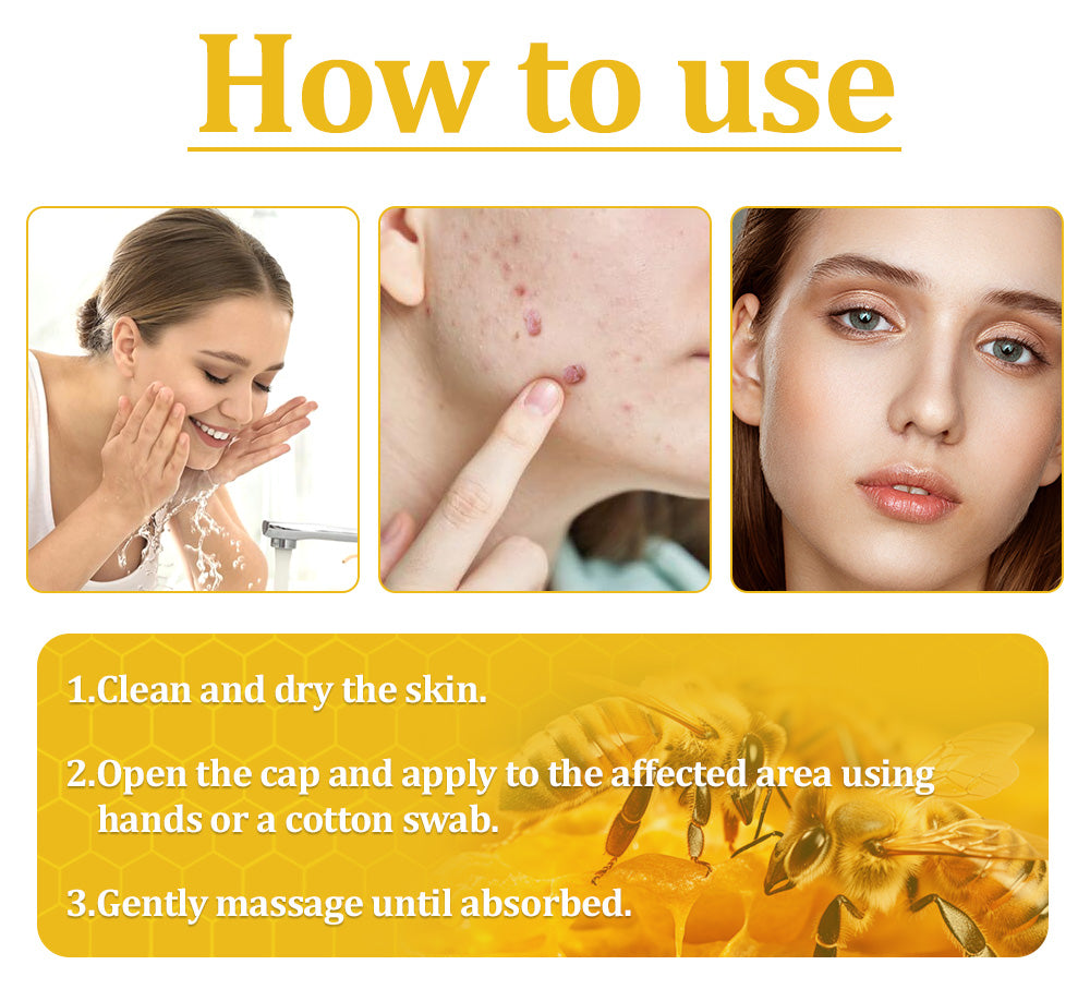 Official Store: TLOPA® Bee Venom Skin Treatment Cream👨⚕️British Association of Dermatologists (BAD) Approved🌻