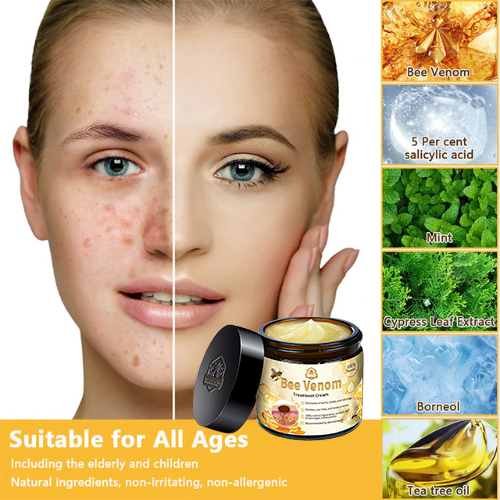 Official Store: TLOPA® Bee Venom Skin Treatment Cream👨⚕️British Association of Dermatologists (BAD) Approved🌻
