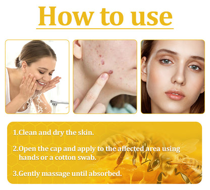 Official Store: TLOPA® Bee Venom Skin Treatment Cream👨‍⚕️British Association of Dermatologists (BAD) Approved🌻