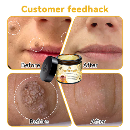Official Store: TLOPA® Bee Venom Skin Treatment Cream👨‍⚕️British Association of Dermatologists (BAD) Approved🌻